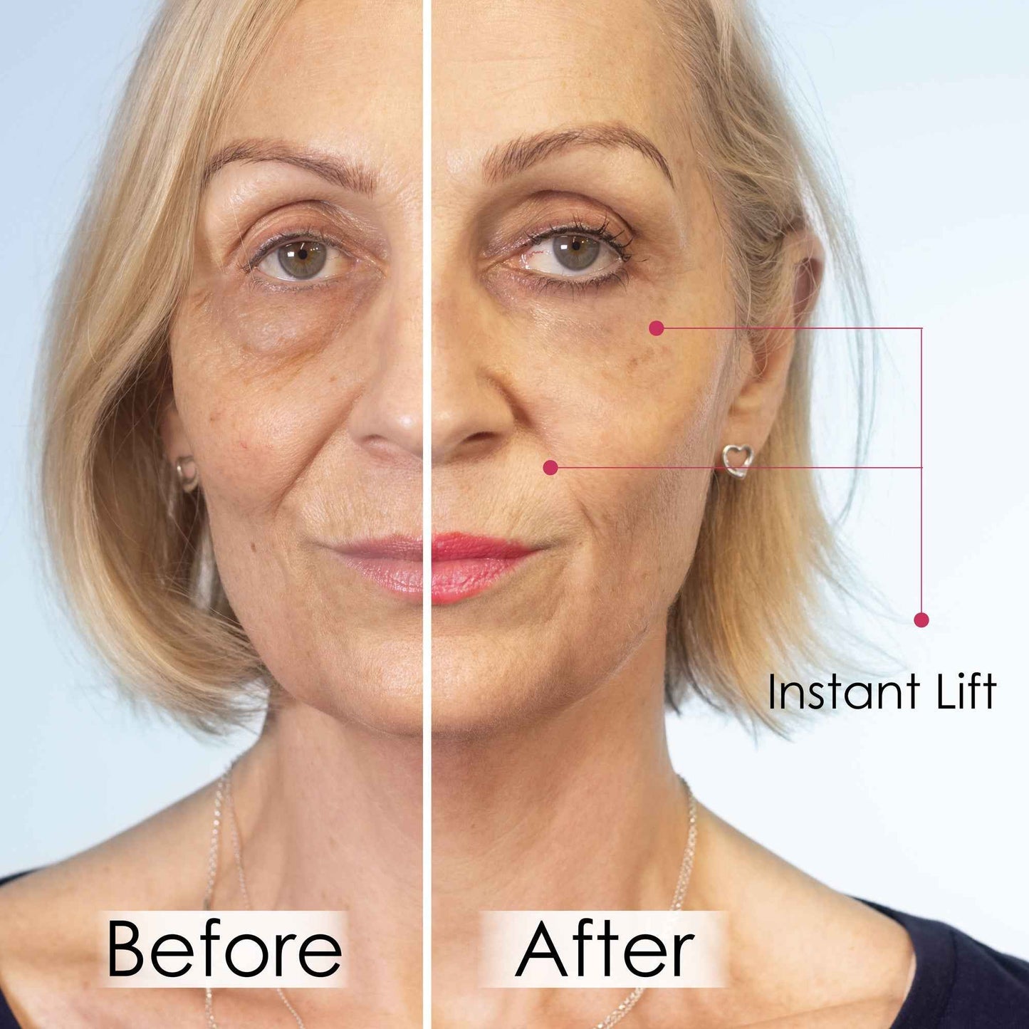 Wrinkle Killer Instant Lift with Hyaluronic Acid & Peptides